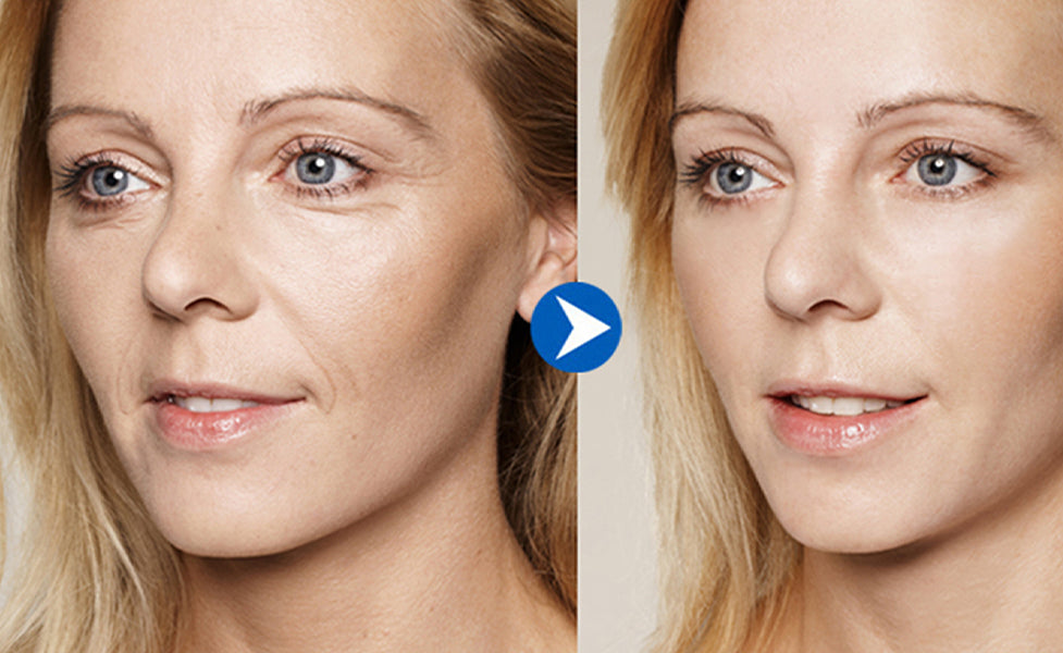 Redescubre tu confianza con nuestro Suero Facial Esencial